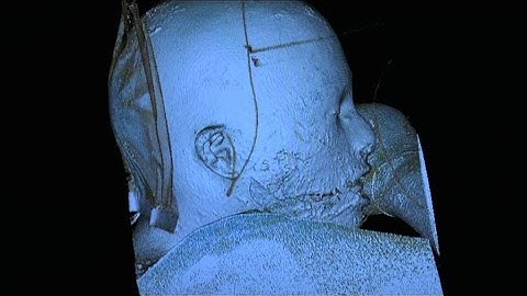 The future of forensic science in Australia