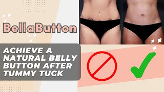 Why Your Belly Button is the Most Important Part of a Tummy Tuck