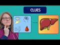 Liver Dysfunction: How Nurses Recognize the Pattern #clinicaljudgment #nursingstudent #hepatic