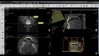 EZ3D PLUS 09 Herramienta de Medicion