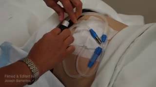 PART 2 - How to attach a Baxter transfer set to a Fresenius C.A.P.D. catheter