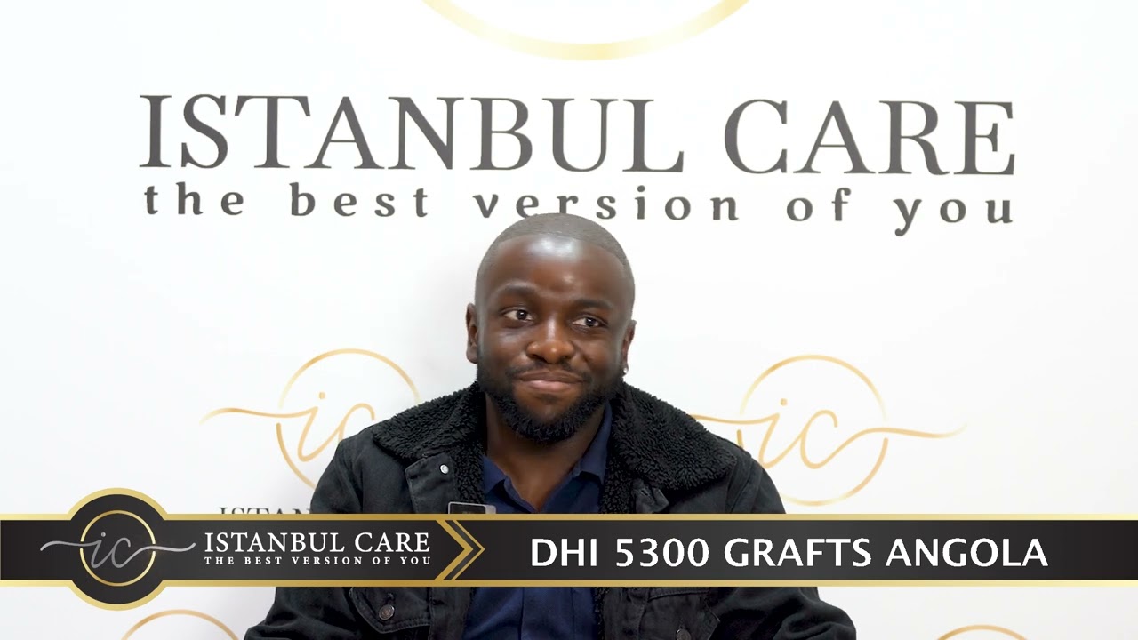 Life-Changing Hair Transplant Experience: Client from Angola