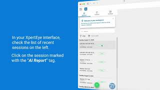 How to consult my AI Reports with XpertEye