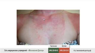 Аллергический зуд у взрослых и детей Аллергический зуд у взрослых и детей