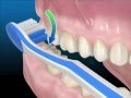 Tecniche di igiene orale: Uso corretto dello spazzolino da denti