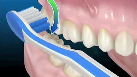 Tecniche di igiene orale: Uso corretto dello spazzolino da denti