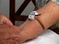 Demostração de auto hemoterapia pelo Dr Luiz Moura
