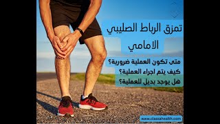 تمزق الرباط الصليبي ، متى وكيف يمكن العلاج بعملية جراحية ؟