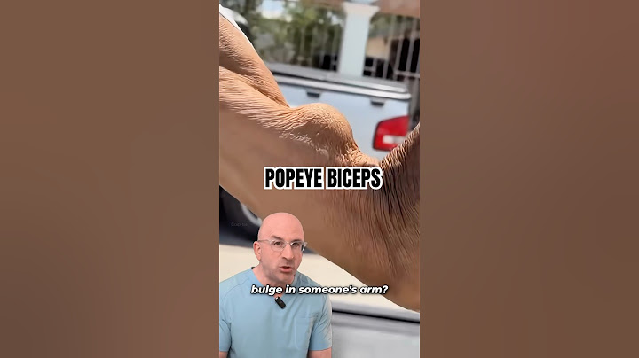 Secret To Biceps Tear WITHOUT Popeye Muscles⁉️