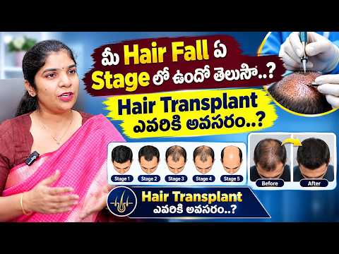 Hair Fall Stage తెలుసా..? 😱Hair Transplant ఎప్పుడు అవసరం | Dr. Shilpa Ponnada | Chiranjeevi Hospital