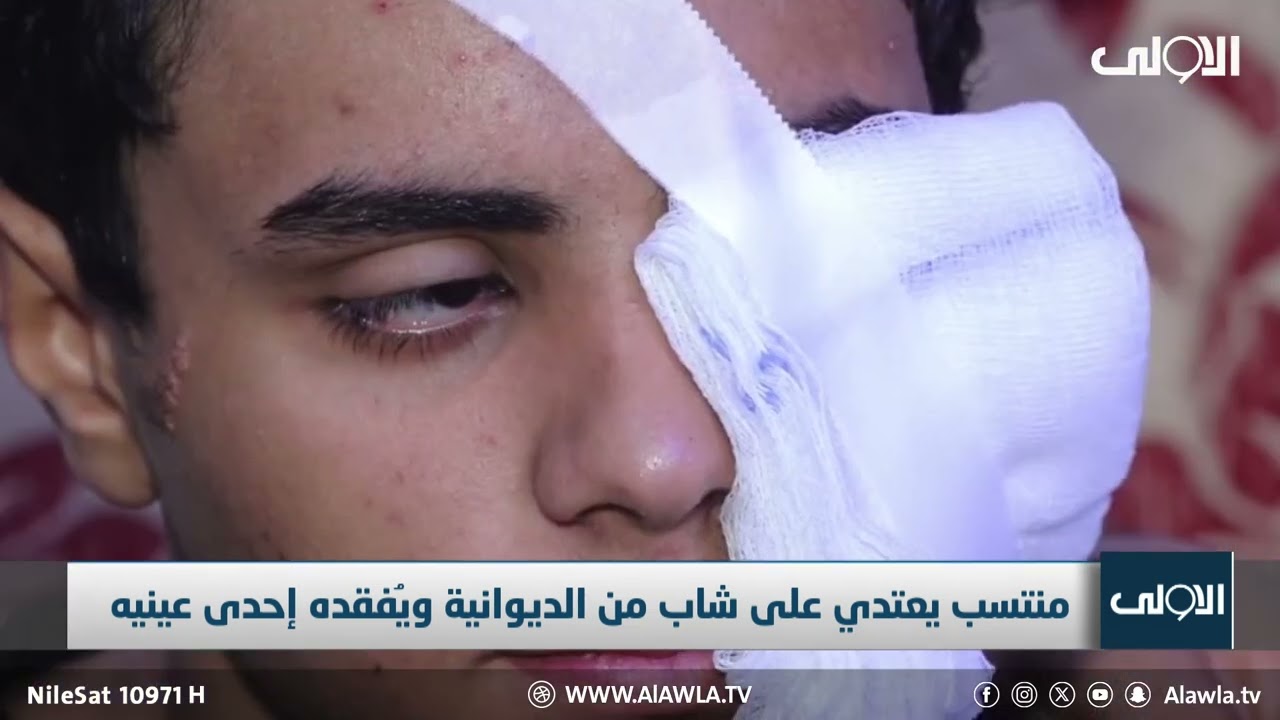 بالدونكي.. منتسب امني يُفقد شاب احد عينيه في الديوانية