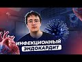 Инфекционный эндокардит. Этиология, патогенез, клиническая картина, диагностика, лечение