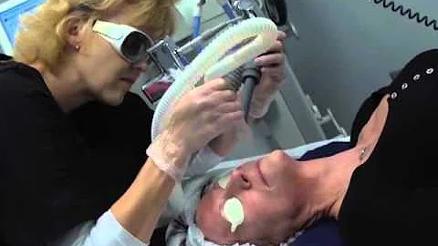 Profractional Laser Skin Resurfacing with Dallas O...