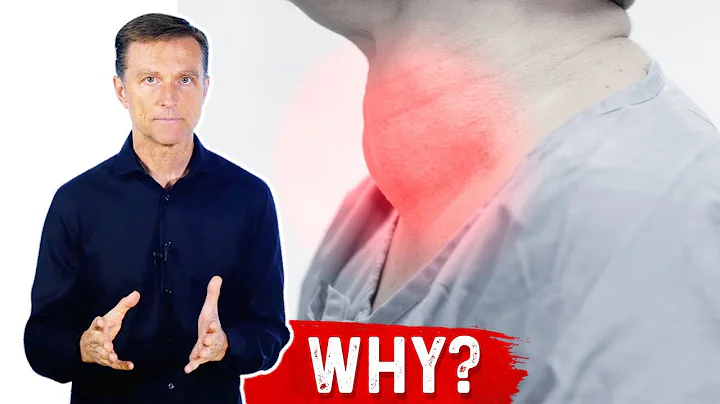 What Causes a Goiter? Iodine Deficiency & Thyroid Nodules – Dr.Berg