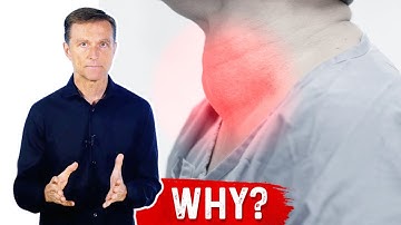 What Causes a Goiter? Iodine Deficiency & Thyroid Nodules – Dr.Berg