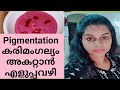 Melasma Treatment|Homemade Face Pack For Pigmentation|കരിമംഗല്യം |Kavi's Lifestyle Lab