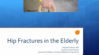 Hip Fracture in the Elderly, Angela Sanford, MD