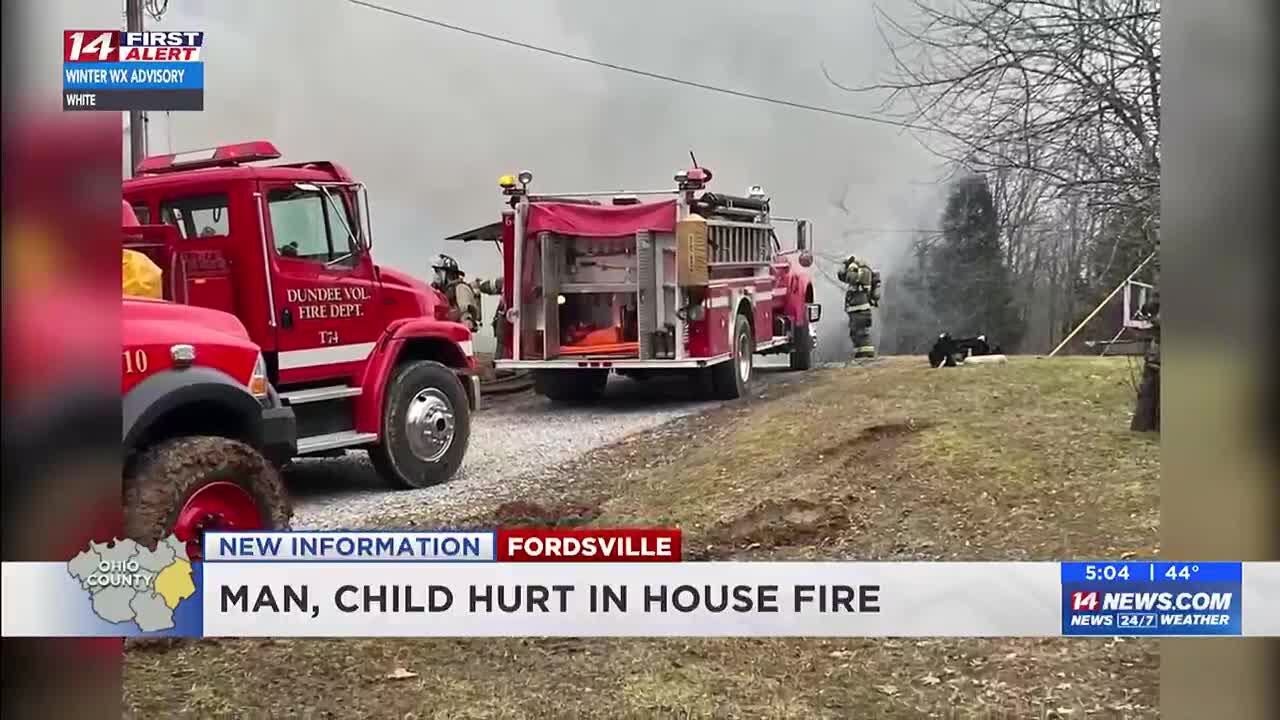 Man and child flown to hospital after fire caused by aerosol near open ...