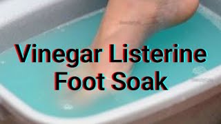 Listerine Vinegar Foot Soak For Soft And Smooth Feet screenshot 3