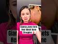 Gianna Joyce Gets Real About Acne Struggles #shorts #giannajoyce #glowhouse