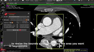 Video instructions for A.I.Segmentation