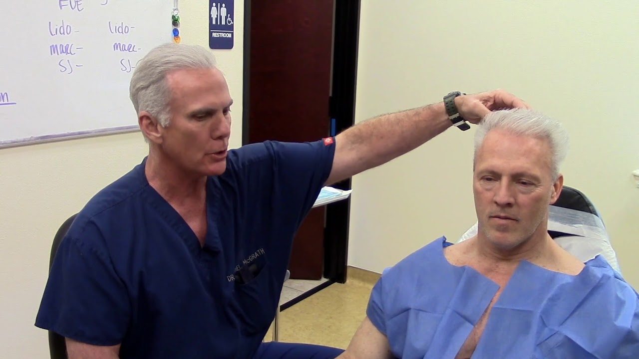 Body Hair Transplant to Head- Beard Hair FUE Transplant to Scalp - YouTube