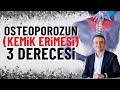 Osteoporoz yani kemik erimesinin 3 derecesi | Dr. Mehmet Portakal