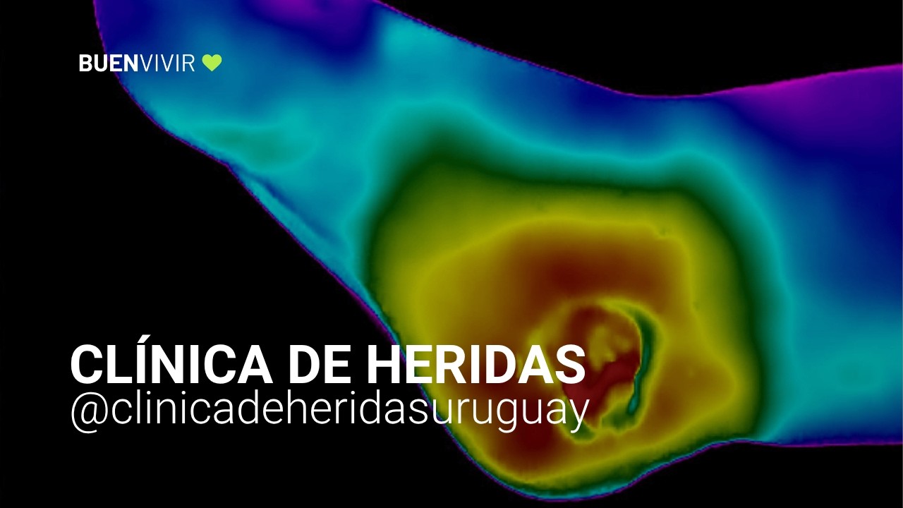 CLÍNICA DE HERIDAS - Lucía García - BUENVIVIR💚 04/08/26 Canal 4