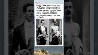 Celebrity The Man with Two Hearts: The Incredible Life of Jean Libbera #shorts #facts #history #mystery Profile