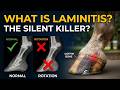 What Is Laminitis? Causes, Symptoms & Treatment Explained