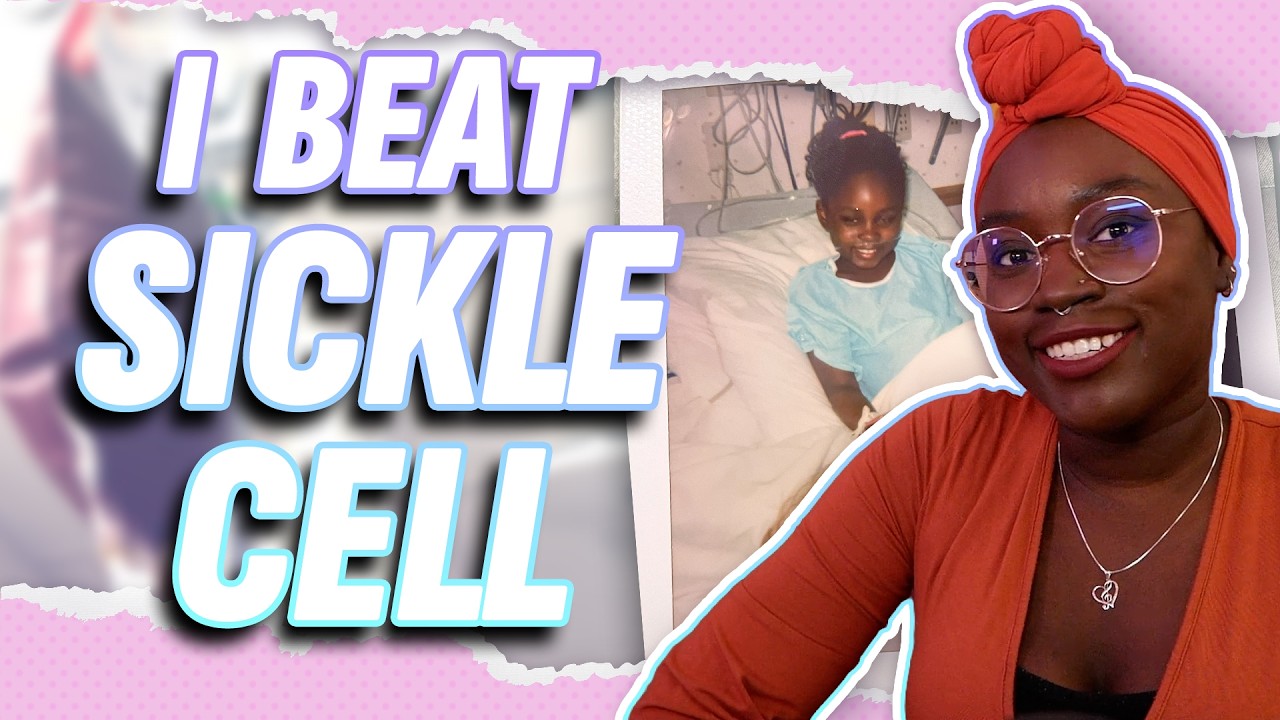 I Got Cured of Sickle Cell