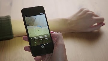 SkinVision: Check Your Skin for Risk of Skin Cancer