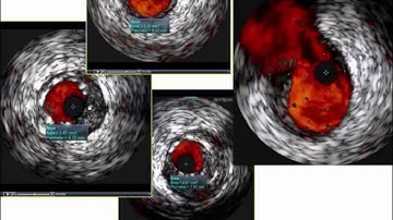 THe New Era of Protected PCI webcast