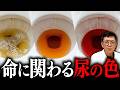 トイレで流す前に見て！「がん」や「腎不全」を知らせる危険な尿の色5選【医師解説】