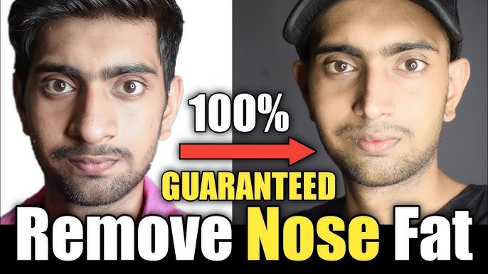 Lose Nose Fat - Get Slim Nose, Nose Reshaping Exercise