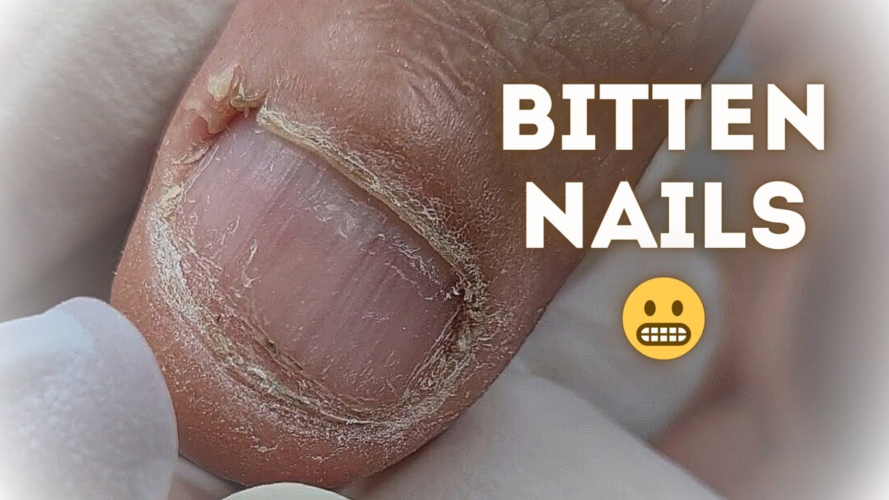 Damaged nails transforming. Male manicure. How to keep natural nails healthy and clean