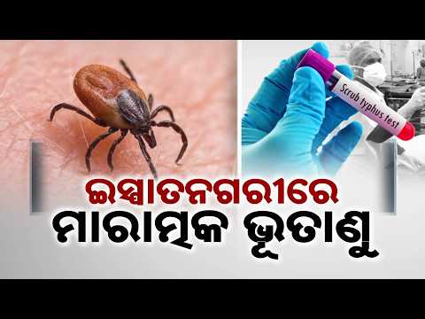 Scrub Typhus Outbreak In Sundargarh: Over 900 Cases, Rourkela On High Alert | Argus News