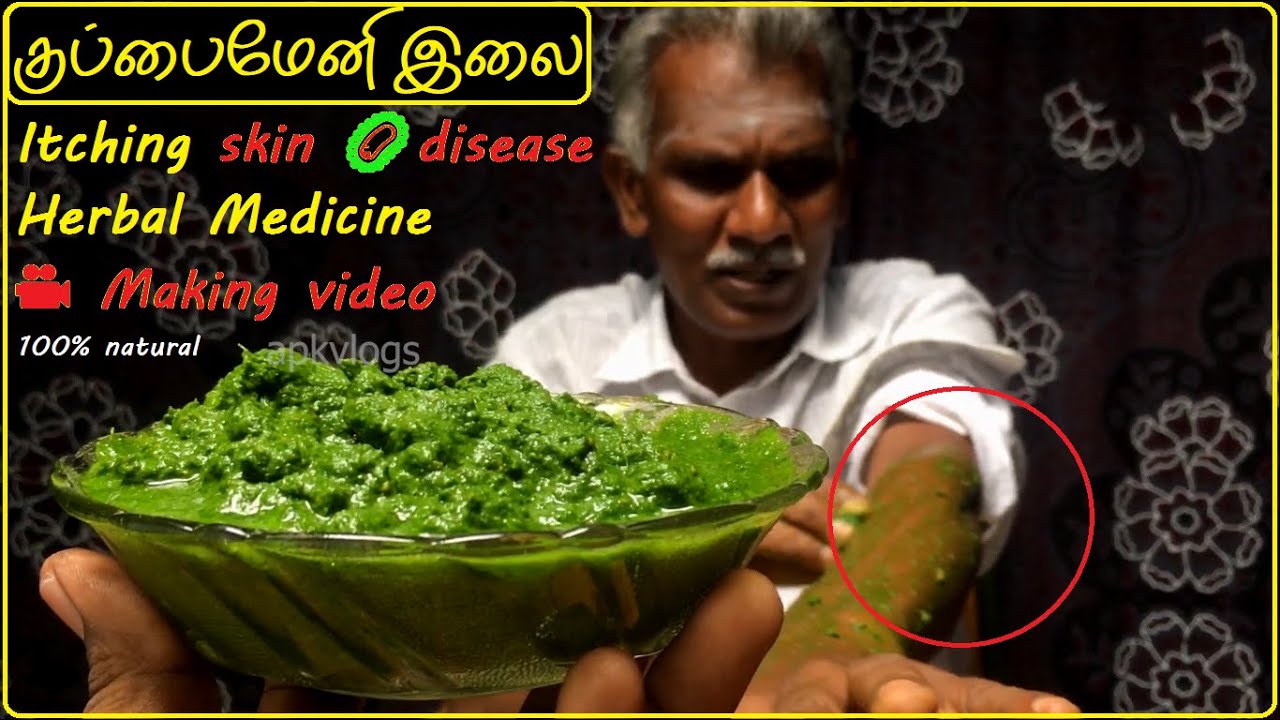குப்பைமேனி இலை 🍃| தோல் அரிப்பு | Itching skin 🦠disease Herbal Medicine 🎥Making video | apkvlogs tips