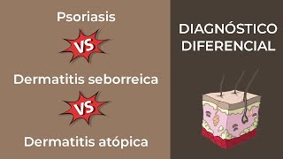 Diagnóstico Diferencial. Enfermedades eritemato descamativas