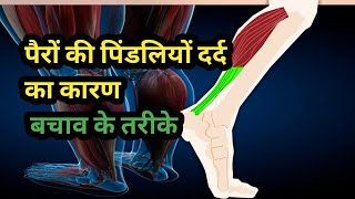पैरों की पिंडलियों में दर्द के कारण / बचाव के तरीके / Calf (legs) pain Causes  / How to cure ? /
