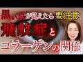 黒い点がみえたら要注意！飛蚊症とコラーゲンの関係とは？
