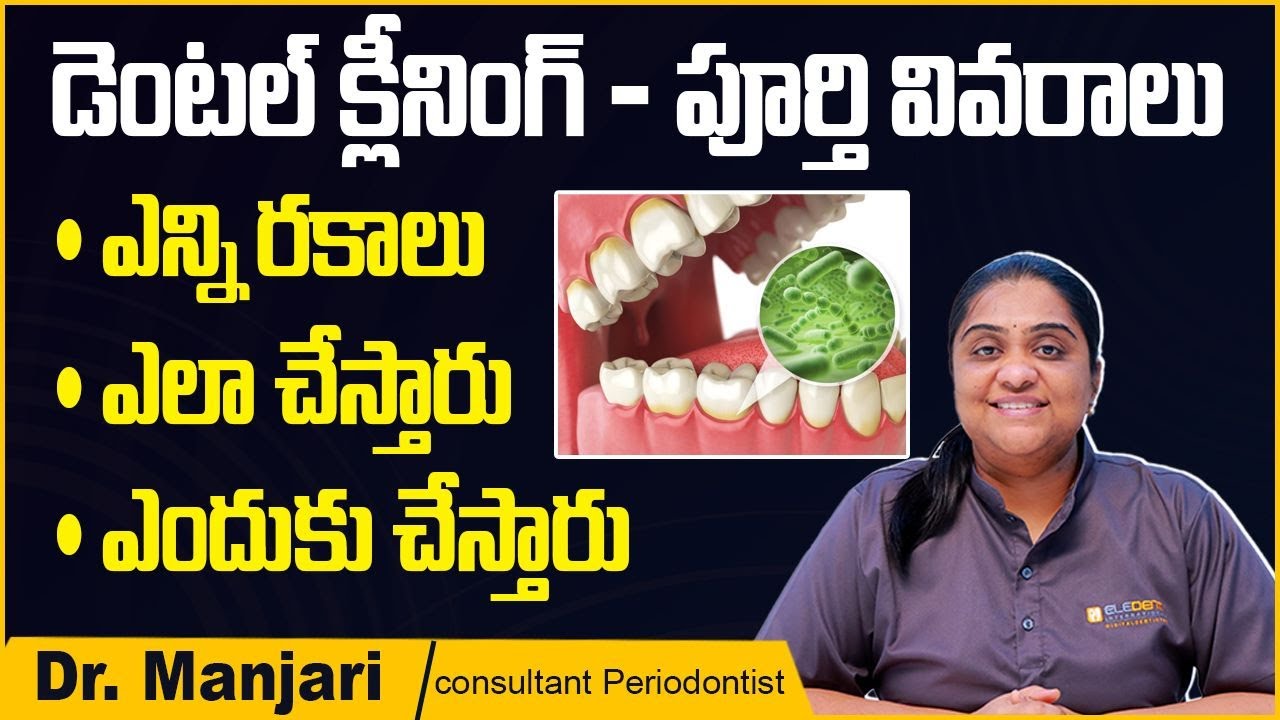 3 Types Of Dental Cleaning Teeth Whitening Tips In 3-types-of-dental-cleaning-teeth-whitening-tips-in