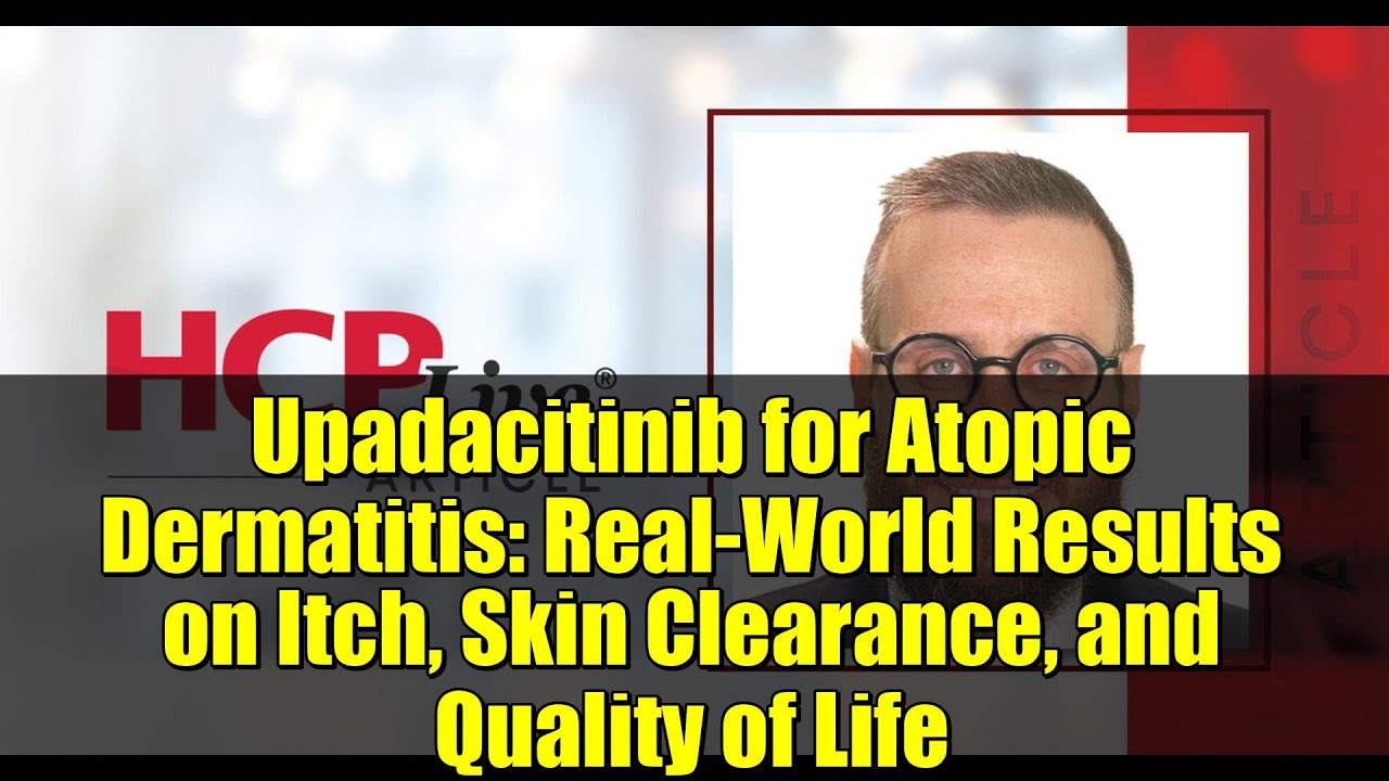 Upadacitinib for Atopic Dermatitis: Real-World Results on Itch, Skin Clearance, and Quality of Life