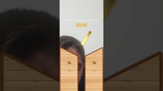 Ne zaman milyoner olacam lan like at abone de ol