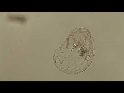 Noctiluca scintillans
