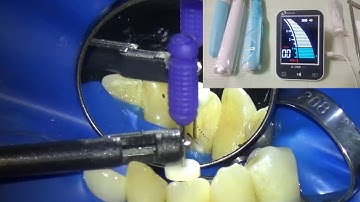 Testing E pex Apex Locator30 4 2018