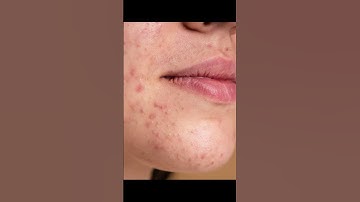 Disaster Management | UPSC CSE | NCSC IAS #upsc #cse #ias #shorts #short #education