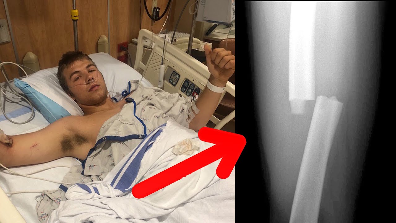 What happens when you send it