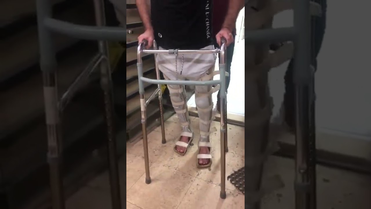 علاج حالة نخاع شوكي مع د / رانيا السيد عبد العليم