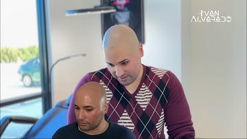 SMP Scalp Micropigmentation Austin, Texas  - Stephen Testimony